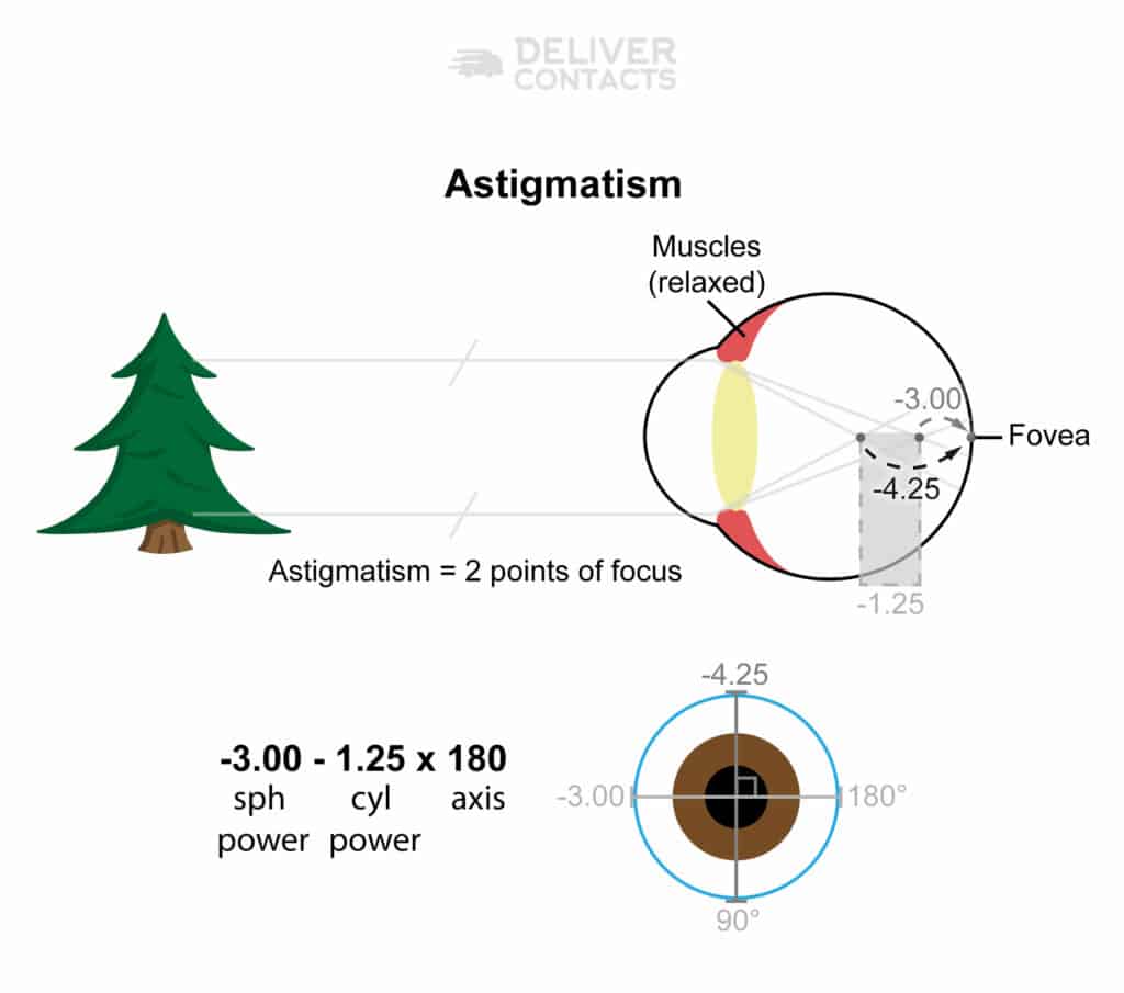 Diagram drawing of an eye with astigmatism focusing at a distance at a pine tree