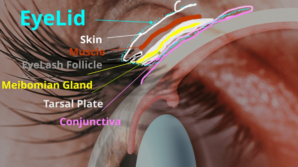 Diagram of the parts of an eyelid