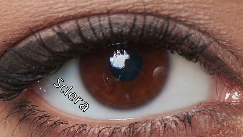 Close up of an eye showing the sclera
