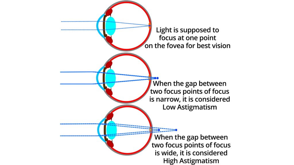 This image demonstrates what low and high astigmatism references mean.