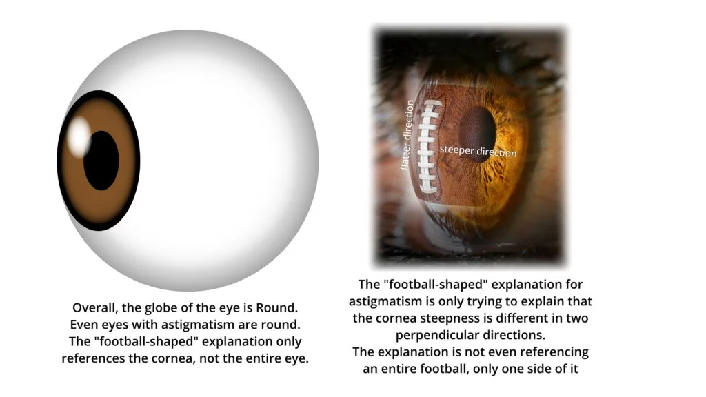 Does Astigmatism Mean the Eye is Shaped Like a Football? This image demonstrates what the phrase "Astigmatism means that your eye is shaped like a football" really means. This globe of the eye is not football shaped, but the cornea has similarities to a football's different curves.