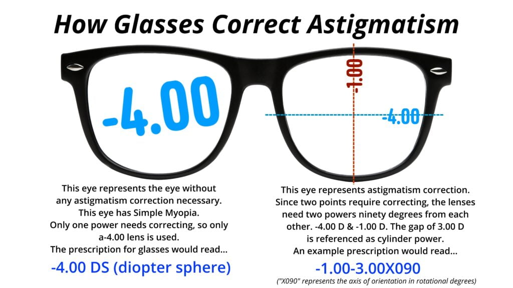 This image demonstrates the difference between correcting an eye with glasses for spherical refractive error and astigmatism refractive error