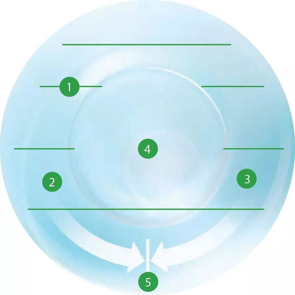 This image represents the different components of the optimized toric lens geometry:
1- uniform horizontal iso thickness
2- wide ballast band
3- smooth, continuous surface
4- larger toric optic zone
5- unique back surface curvature