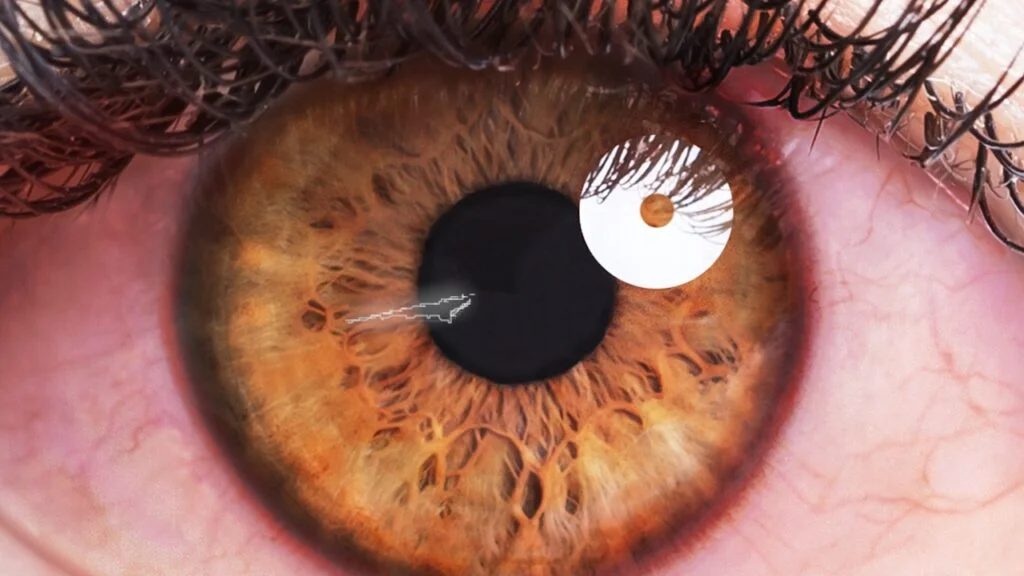 Importance of treating a scratched eye promptly 1